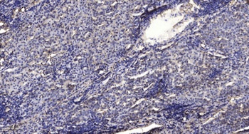 Synapsin-1 (phospho Ser553) rabbit pAb Antibody