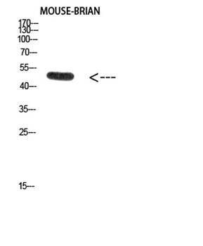 E2F-1 (Acetyl Lys120) rabbit pAb Antibody