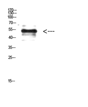 Vimentin (Phospho-Tyr38) rabbit pAb Antibody
