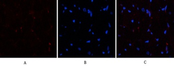 PTEN rabbit pAb Antibody