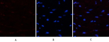 PTEN rabbit pAb Antibody