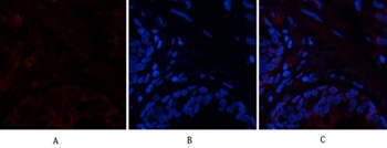 PTEN rabbit pAb Antibody