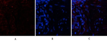 PTEN rabbit pAb Antibody