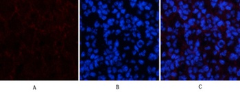 Amyloid-β rabbit pAb Antibody
