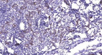 PI 3 Kinase Class 3 rabbit pAb Antibody