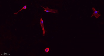 Collagen I rabbit pAb Antibody