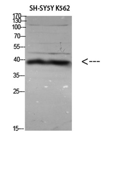 ERLIN1/2 rabbit pAb Antibody