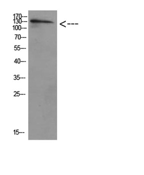 ULK2 rabbit pAb Antibody