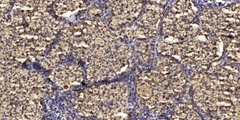 CSH1 rabbit pAb Antibody