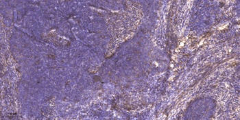 MYOZ2 rabbit pAb Antibody