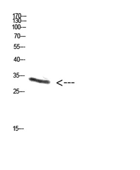 PENK rabbit pAb Antibody
