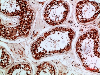 PENK rabbit pAb Antibody