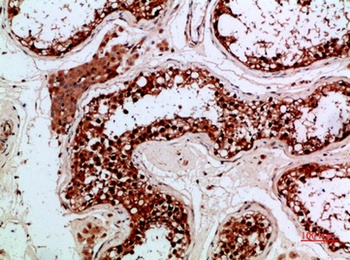 PENK rabbit pAb Antibody