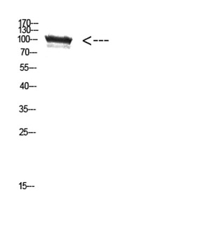 TRPV4 rabbit pAb Antibody