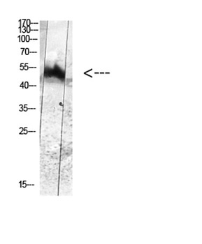 MDM2 (Phospho-Tyr394) Rabbit pAb Antibody