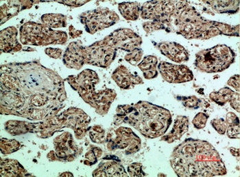 Flk-1/VEGFR2 rabbit pAb Antibody