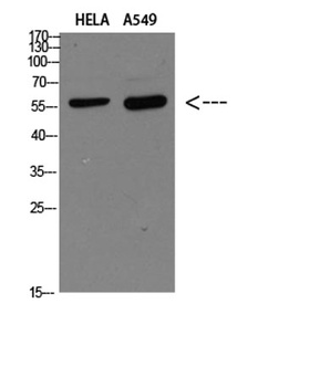 DCT rabbit pAb Antibody