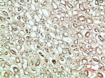 PLK2 rabbit pAb Antibody