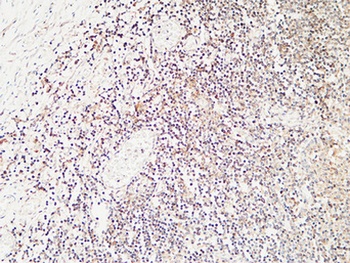 Calcitonin rabbit pAb