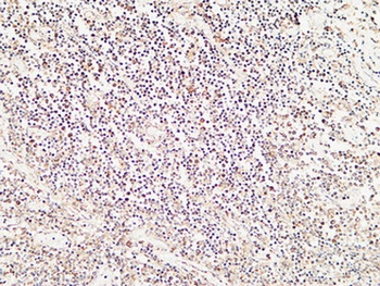 Calcitonin rabbit pAb