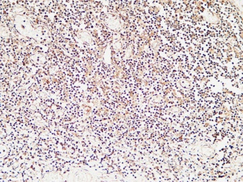 Calcitonin rabbit pAb