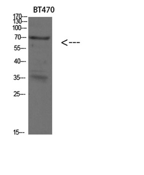 Cytokeratin 4 rabbit pAb Antibody