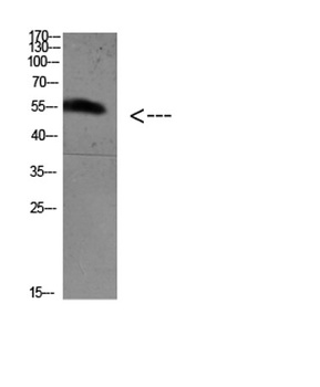 FoxO4 (Acetyl Lys189) rabbit pAb Antibody