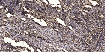 Keratin-pan rabbit pAb Antibody