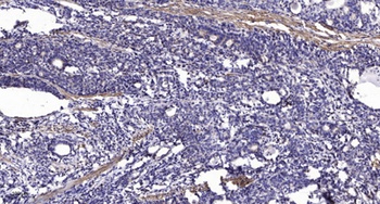 Ku-70 (Acetyl Lys317) rabbit pAb Antibody