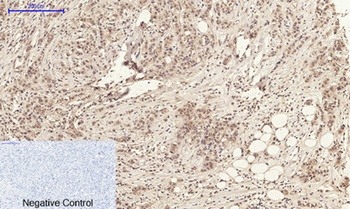 Annexin I rabbit pAb Antibody