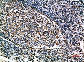 Cystatin A rabbit pAb Antibody