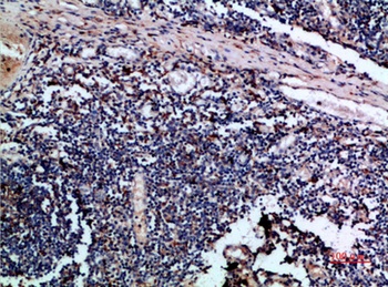 Cystatin A rabbit pAb Antibody