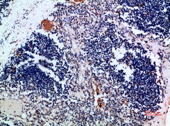 Cystatin A rabbit pAb Antibody