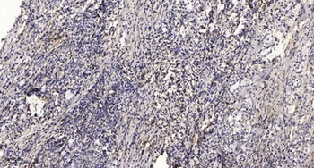 TIM-1 rabbit pAb Antibody
