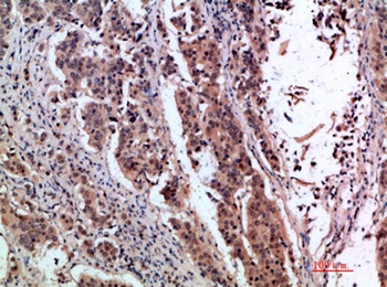 pS2 rabbit pAb Antibody