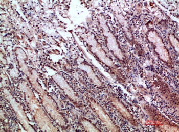 pS2 rabbit pAb Antibody