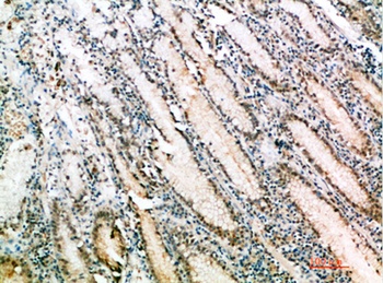 pS2 rabbit pAb Antibody