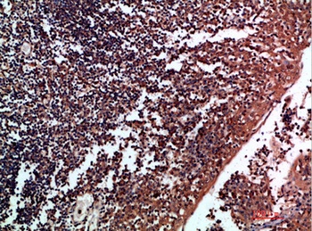 Tenascin-R rabbit pAb Antibody