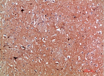 Tenascin-R rabbit pAb Antibody