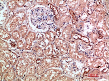 CD11b rabbit pAb Antibody