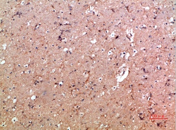 CD11b rabbit pAb Antibody