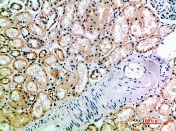 CD158k rabbit pAb Antibody