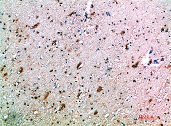 CD314 rabbit pAb Antibody