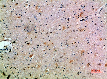 CCL14 rabbit pAb Antibody