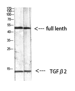 TGFβ2 rabbit pAb Antibody