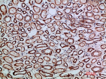 TGFβ2 rabbit pAb Antibody