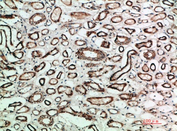 TGFβ2 rabbit pAb Antibody
