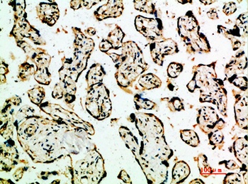 TGFβ2 rabbit pAb Antibody