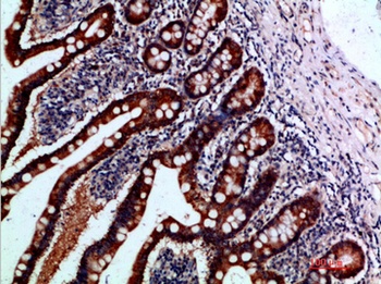 IL-1F7 rabbit pAb Antibody