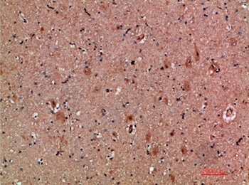 NNT-1 rabbit pAb Antibody